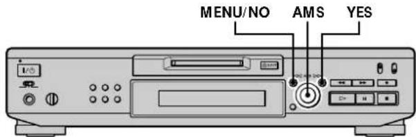 SONY MDSJE530 - Undoing the Last Edit - 1