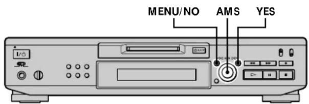 SONY MDSJE530 - Anulación de laULTaedition - 1