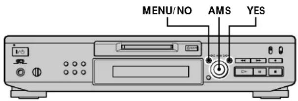 SONY MDSJE530 - Cambio del tono (Funcion de control del tono) - 1