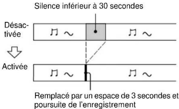 SONY MDSJE470 - Suppression automatique des silences (Smart Space/Auto Cut) - 1
