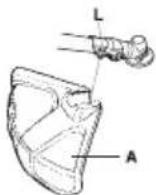 HUSQVARNA 129LK - Montage de la protection de la tête et de la tete de déssherbage - 4