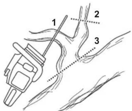 HUSQVARNA 543 XP - To use the limbing technique - 3