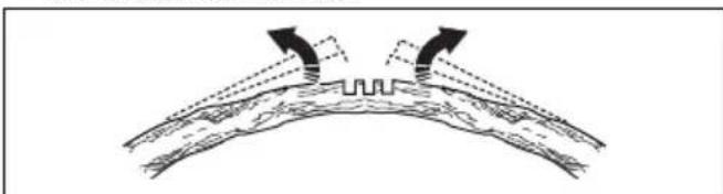 HUSQVARNA 543 XP - Cortar árvores e ramos sob tensão - 7
