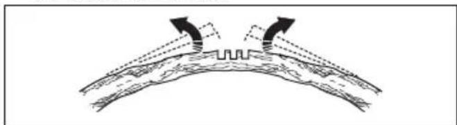 HUSQVARNA 543 XP G - Cortar árvores e ramos sob tensão - 6