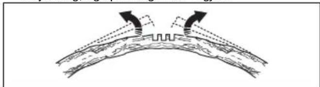 HUSQVARNA 120i - Frigjore et fastsatt tre - 7