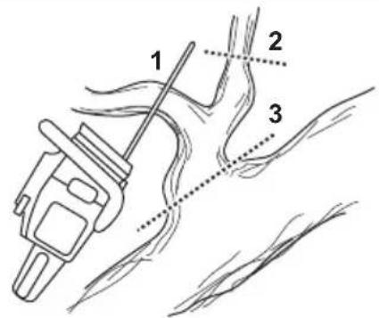 HUSQVARNA 120i - Karsintatekniikan kayttäminen - 2