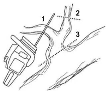 HUSQVARNA 120i - To use the limbing technique - 2