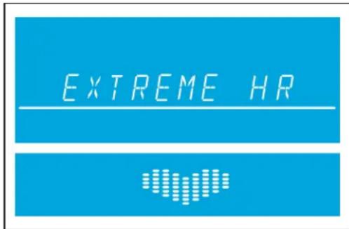 Life Fitness RS3 Go - Exercice Extreme Heart Rate (Fréquence cardiaque/Extreme) (Avancé - Athlène) - 1