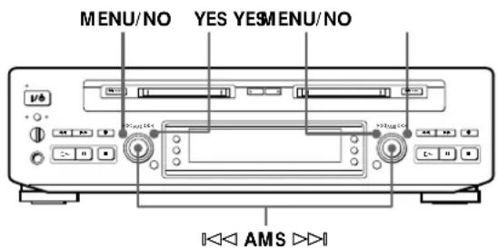 SONY MDSW1 - Annulation du dernier montage (fonction Undo) - 1