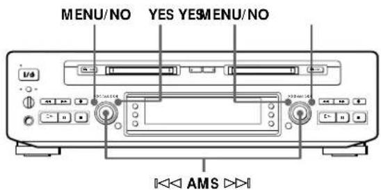 SONY MDSW1 - Undoing the Last Edit (Undo Function) - 1