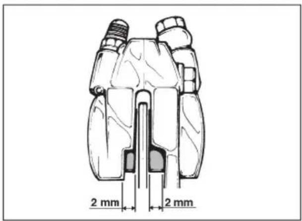 Beta ALP 200 (2011) - To avoid burns, put on protective gloves before performing the operation. - 3