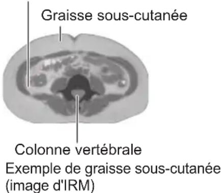 OMRON VIVA HBF222TEBK - Graisse sous-cutanée = graisse située sous la peau - 1