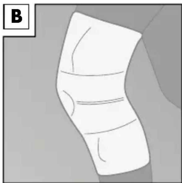 Sensiplast IAN 31206 - Anlagen der Bandage - 2