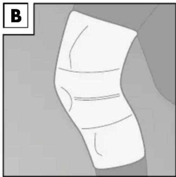 Sensiplast IAN 31206 - Pose du bandage - 2