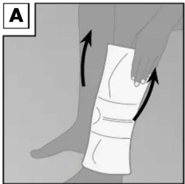 Sensiplast IAN 31206 - Applying the brace - 1