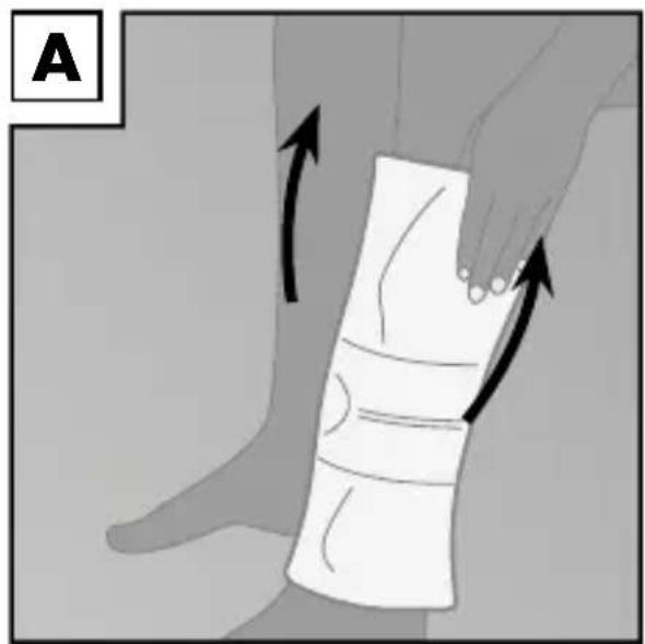 Sensiplast IAN 31206 - Pose du bandage - 1