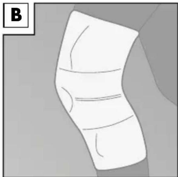 Sensiplast IAN 31206 - Applying the brace - 2