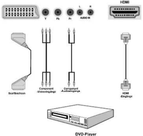 CONTINENTAL EDISON 81HD905V - Anschluss eines DVD-Players - 1