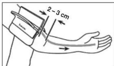 BEURER BM 51 easyClip - Applicazione del manicotto - 2