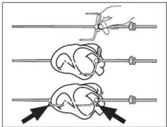 ARTHUR MARTIN ELECTROLUX FE 6467 - Enfilez l'aliment sur la broche - 2