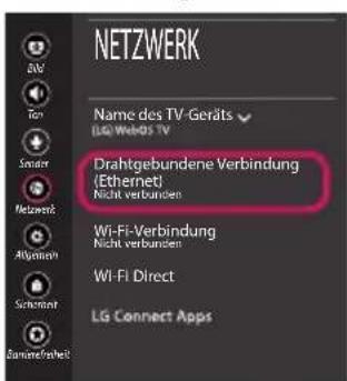LG 55UK6470PLC - Behebung von Netzwerkproblemen - 6