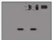 ANGELCARE AC423D - TO SELECT THE CHANNEL: - 1