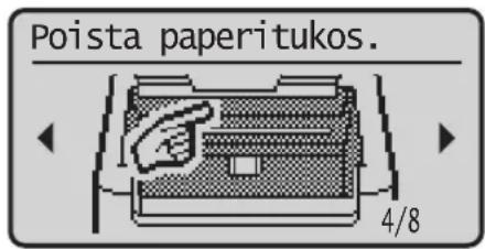 CANON iSENSYS MF113w - Laite ei näytä toimivan On esiintynyt paperitukoksia - 3