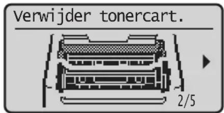 CANON iSENSYS MF113w - De verbruiksartikelen vervangen - 1