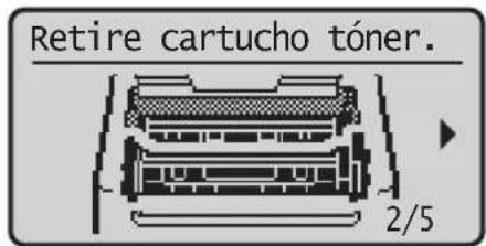 CANON iSENSYS MF113w - Sustitución de los consumibles - 1