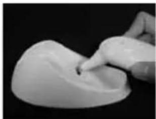 MICROLIFE IR 1DB1 - Cómo cambiar el Capuchón Protector - 2