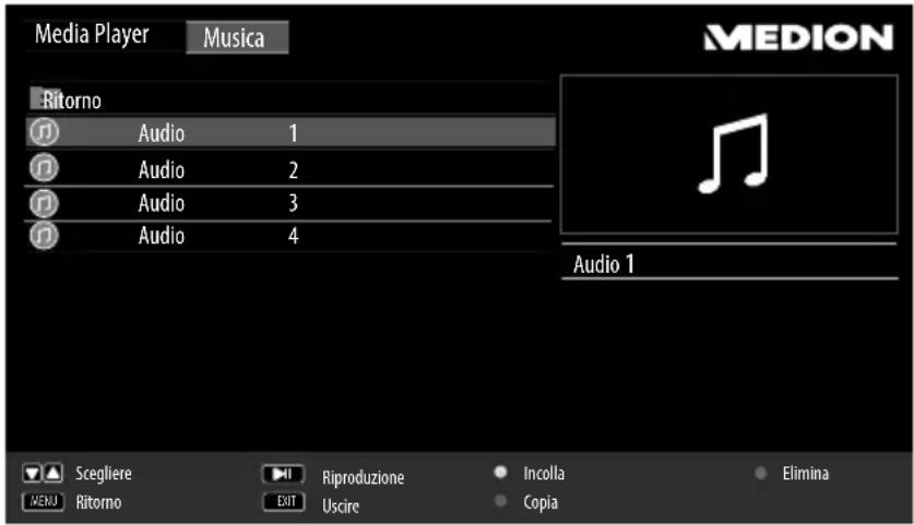 MEDION LIFE P12255 (MD 21350) - Riproduzione di musica - 1