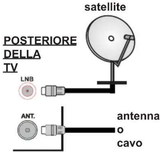MEDION LIFE S18037 (MD 31113) - Collegamento Antenna - 1