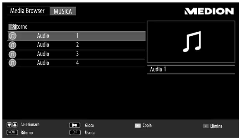 MEDION LIFE P15229 (MD 31168) - Riproduzione di musica - 1