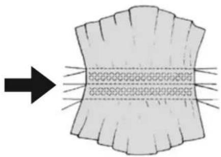 MEDION MD 15694 - Langettenstiche - 1