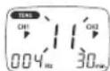 SANITAS SFT 09 - Svolgimento per i programmi EMS/TENS da 11 a 20 (programmi personalizzati) - 2
