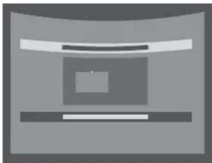 SONY VPLCW276 - Correzione della distorsione ②- Bordi superiore e inferiore dell'immagine - 3