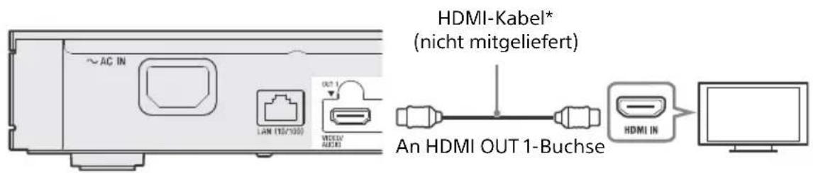 SONY UBPX1100ES - Anschließen an Ihr Fernsehgerät - 1