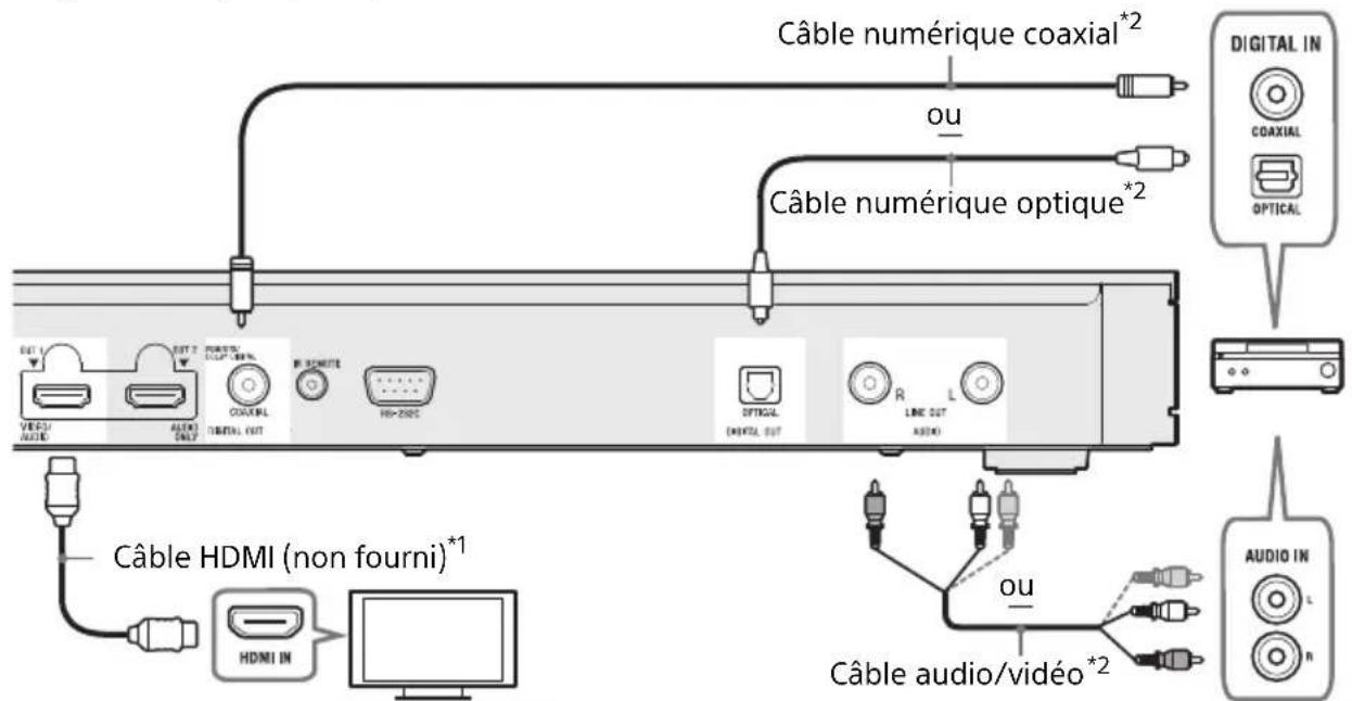 SONY UBPX1000ES - Amplificateur (récepteur) AV non 4K sans HDMI IN - 1