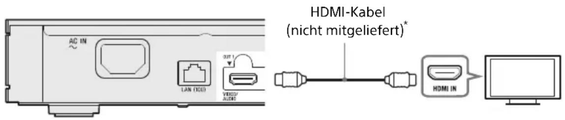 SONY UBPX1000ES - AnschlieBen an Ihr Fernsehgerät - 1
