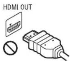 SONY UBPX1000ES - PRECAUTIONS - 1