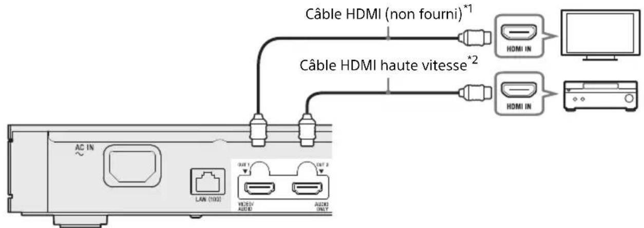 SONY UBPX1000ES - Amplificateur (récepteur) AV non 4K avec HDMI IN - 1