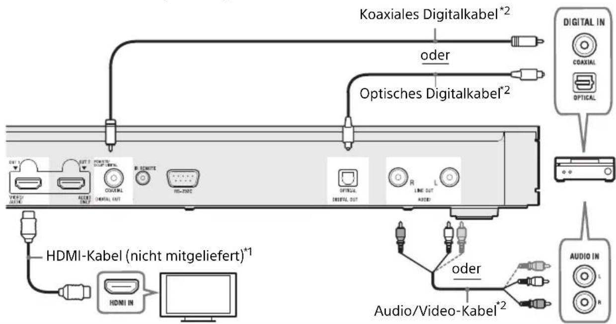 SONY UBPX1000ES - Nicht-4K AV-Veränderer (Receiver) ohne HDMI IN - 1