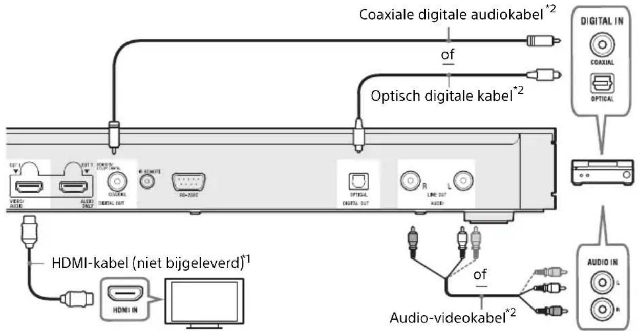 SONY UBPX1000ES - Niet-4K AV-versterker (receiver) zonder HDMI-IN - 1