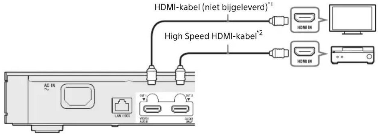 SONY UBPX1000ES - Niet-4K AV-versterker (receiver) met HDMI-IN - 1