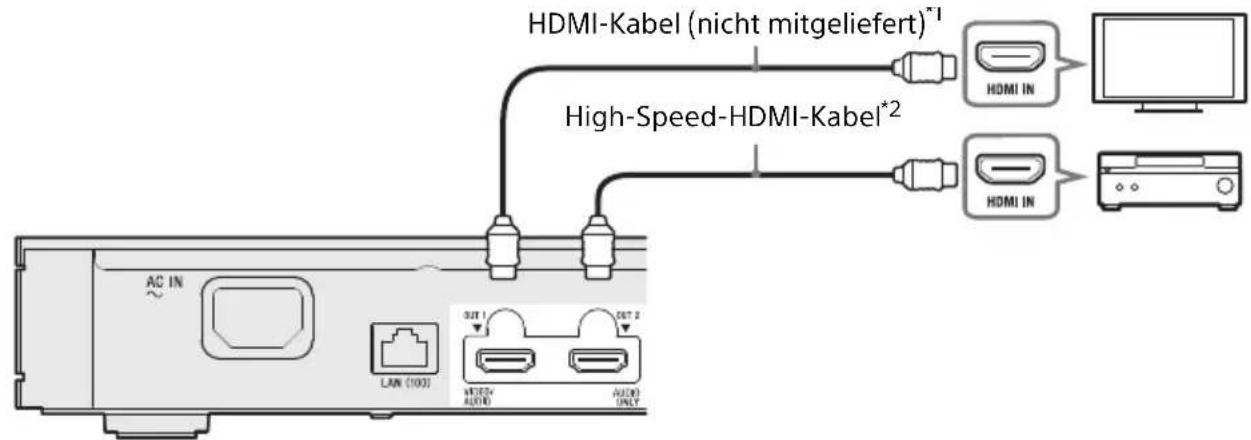 SONY UBPX1000ES - Nicht-4K AV-Veränderer (Receiver) mit HDMI IN - 1