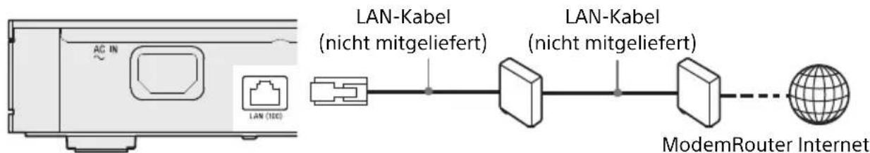 SONY UBPX1000ES - Kabeleinrichtung - 1
