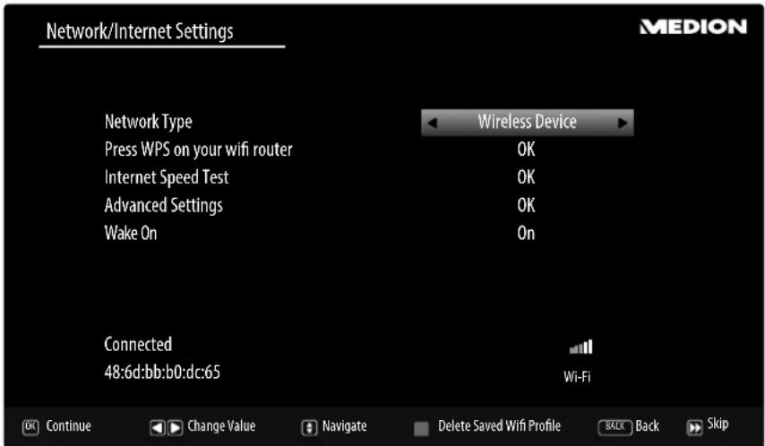 MEDION LIFE P15026 (MD 31326) - Network/Internet settings - 1