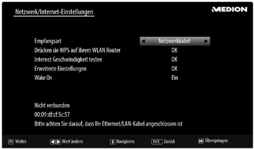 MEDION LIFE P13936 - Netzwerk/Internet-Einstellungen - 1