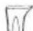 MOULINEX Brio IM3060E0 - 4