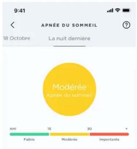 WITHINGS Sleep Analyzer - Faciliter le diagnostic de l'apnée du sommeil : - 1